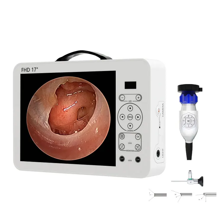 Set Sistem Diagnostik THT Otos - Medical Lab Images ulasan dan harga